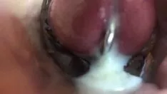 চালান টর্চ কামস্ট্রোক ডাইজেস্ট